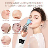 Blackhead Remover Pore Vacuum